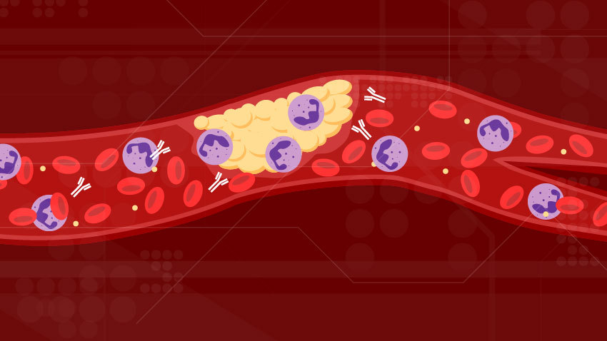 photo showing how blood thinners affect the blood
